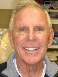 Man with a great smile After Hybridge Dental Implants