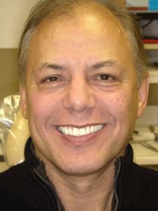 Man with a great smile After Hybridge Dental Implants