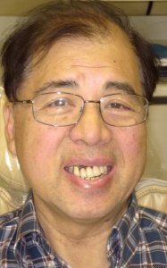 Man with crooked teeth Before Hybridge Dental Implants