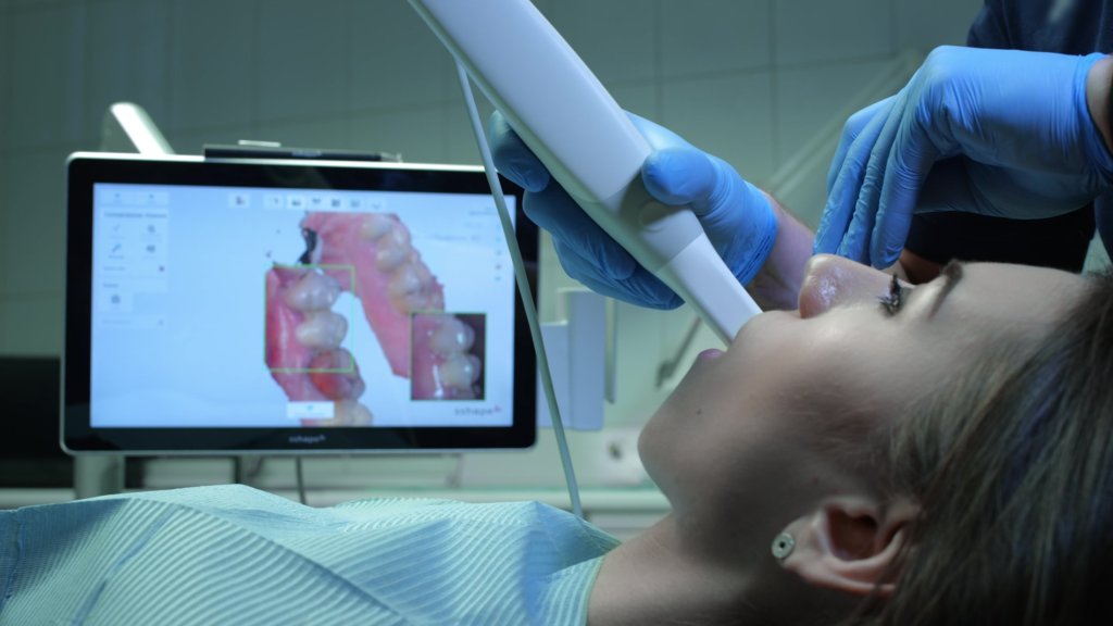 doctor scanning patient's teeth